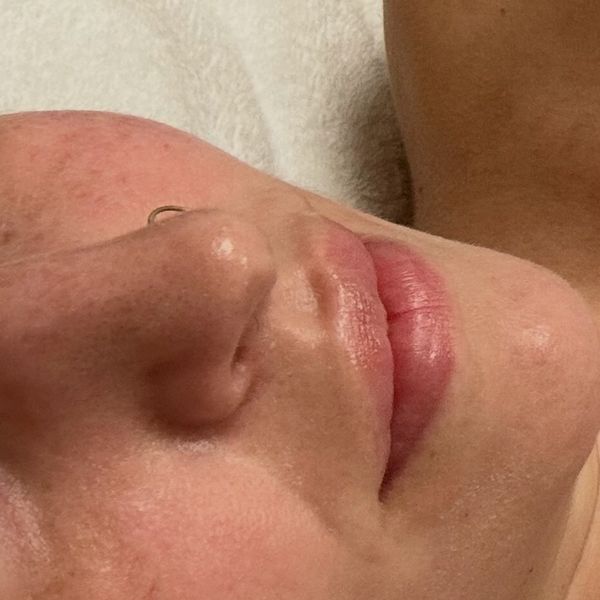 Close-up of a person's nose, lips, and cheek with a nose ring.