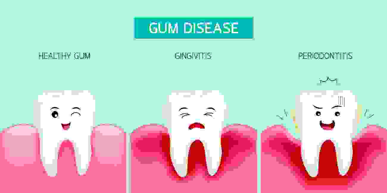 gum diseae dentist in lake worth 