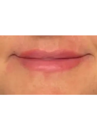 Close-up of a person's lips with natural skin tone.