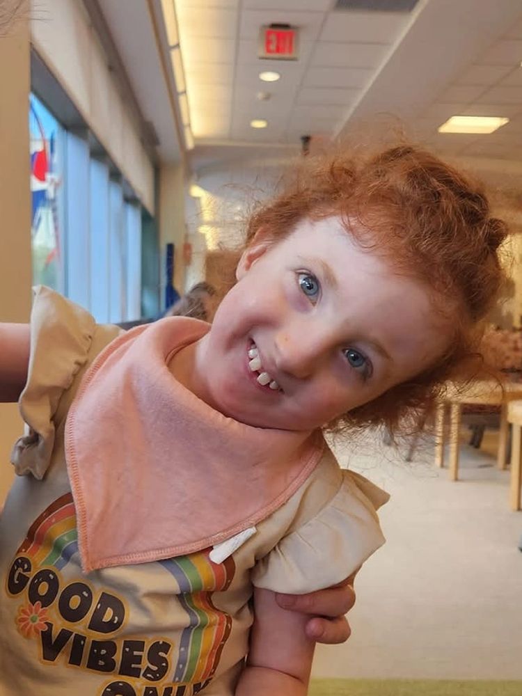 Harley Hart smiling child with Trisomy 18