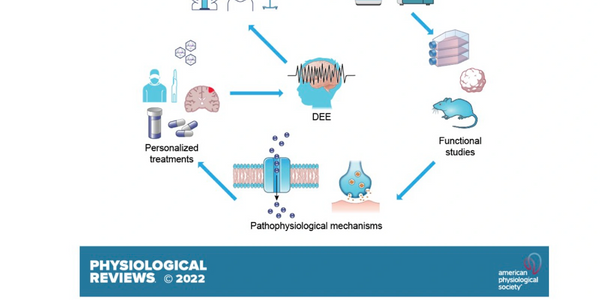Flowchart illustrating diagnosis, genetic studies, functional studies, pathophysiological mechanisms, and personalized treatments for DEE.