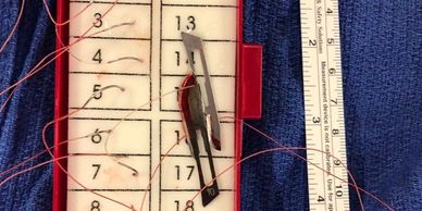 Photo of sutures