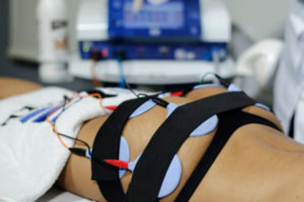 Corrente Aussie e um estímulo elétrico usado para fortalecimento muscular e no combate a flacidez. 