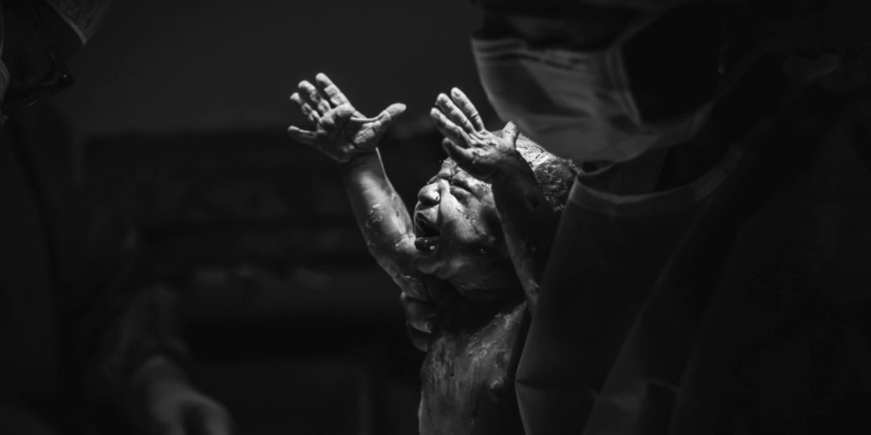 Newborn baby crying moments after birth in a dimly lit delivery room.