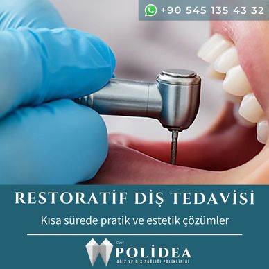 Polidea Restoratif diş tedavisi çürük tedavisi, estetik Gülüş tasarımı diş kırıkları
diş beyazlatma
