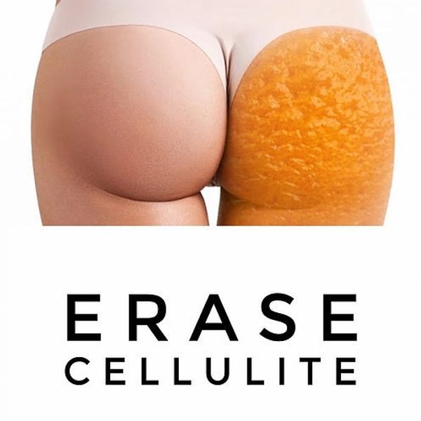 Advanced cellulite treatments in London