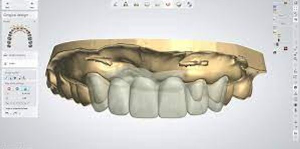 Front Teeth design 