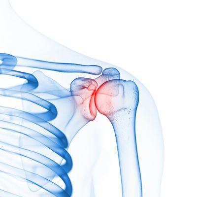 Shoulder Pain