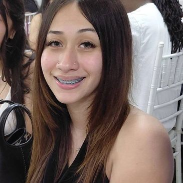 Young woman with braces smiles at a social event.