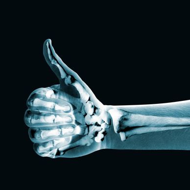 bone fracture healing faster strong bones calcium fast recovery