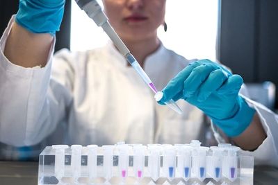 Person with blue gloves and a Pipette testing cannabis samples for pesticides.