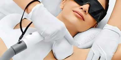 laser hair removal in Burlington
