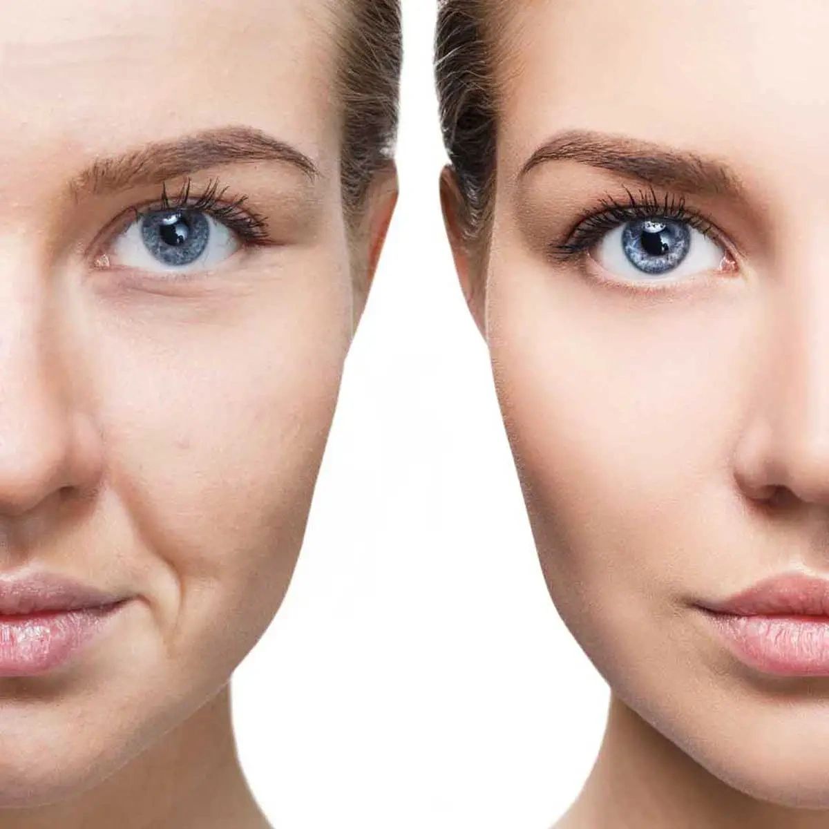 Facial Skin Castle Hill Microneedling beauty salon