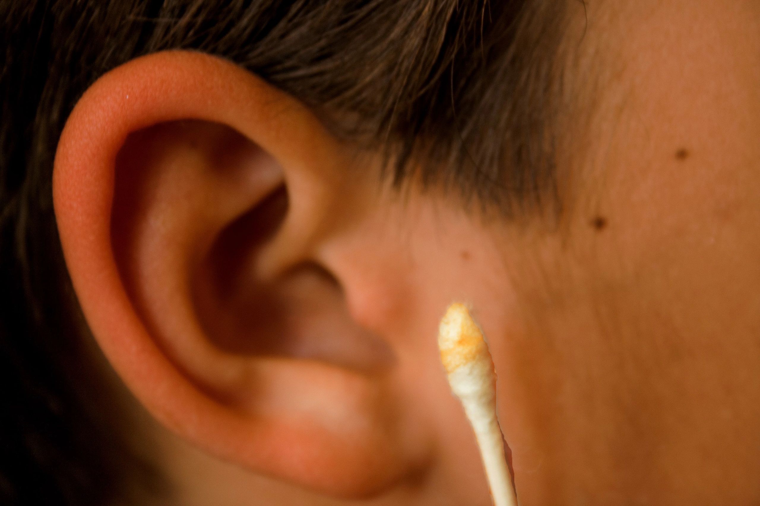 Crystal Clear - Ear Wax Removal, Ear Syringing, Microsuction Ear Wax Removal