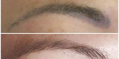 Permanent makeup removal, microblading removal.   Remove unwanted microblading ink.