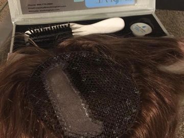 Semi-permanent hair topper for thinning hair 
