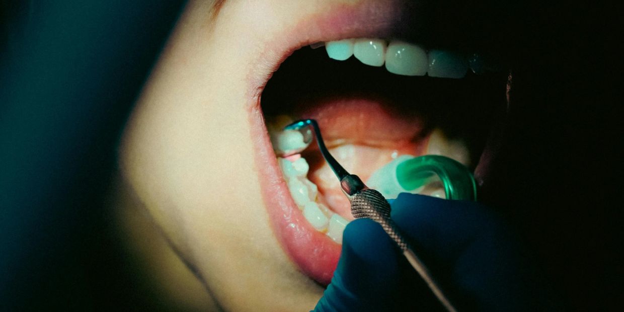 Close-up of dental cleaning inside an open mouth with dental tools.