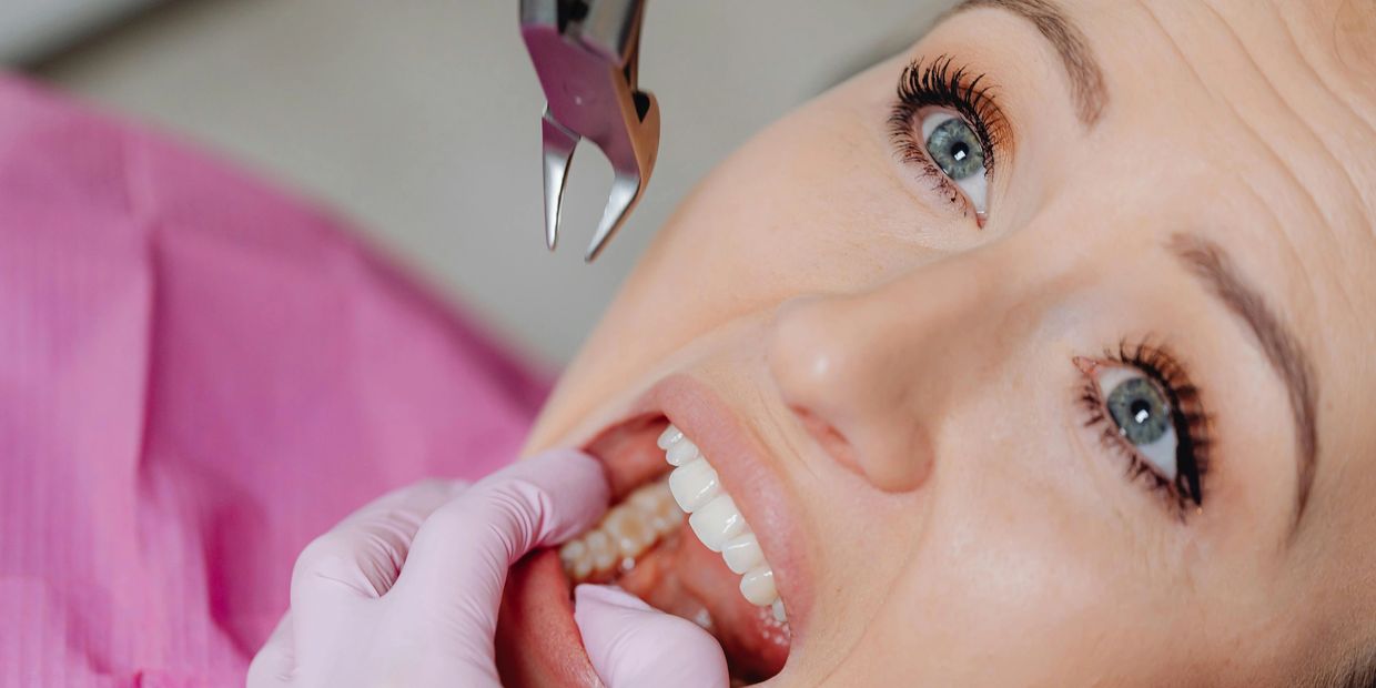 Close-up of a woman at the dentist with dental pliers near her mouth.