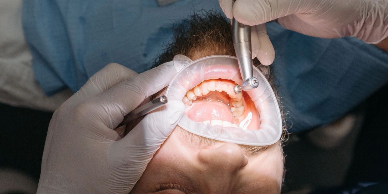Dentist performing dental cleaning on a patient.