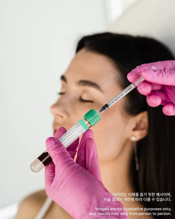 Medical professional preparing a syringe with blood sample from a test tube.