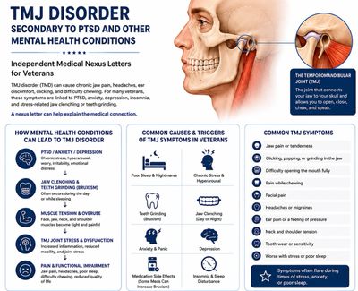 Image describing how TMJ can be caused by PTSD and other mental health conditions. 