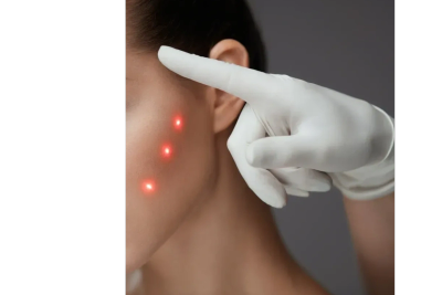 Gloved hand pointing at three red laser dots on a woman's cheek.