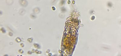 Rotifer under a microscope 