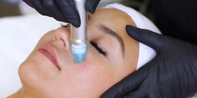 Facial for healthy skin, smaller and clean pores