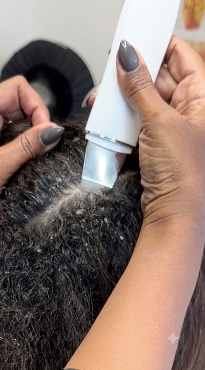 Close-up of scalp treatment using a white ultrasonic skin scrubber device.