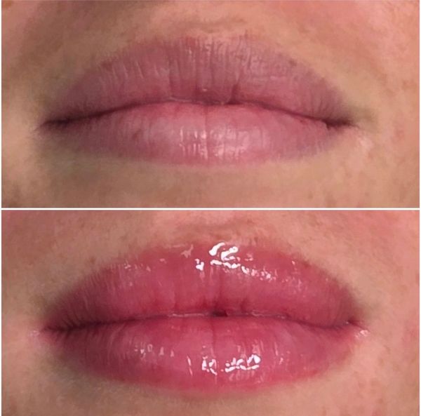 Before and immediately after Lip Blushing