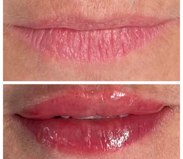 Before and immediately after Lip Blushing