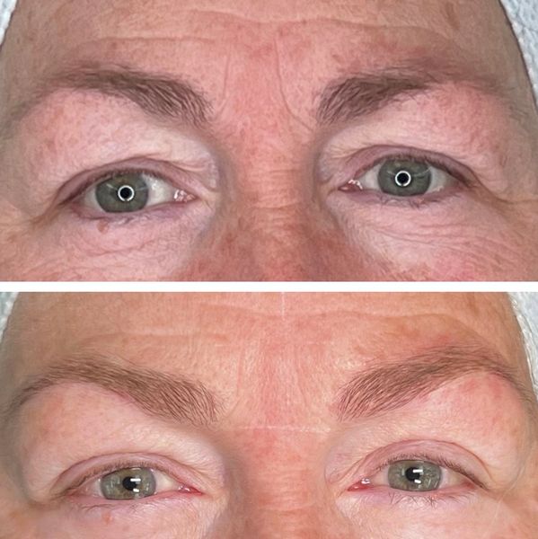 Before and after Microblading only
