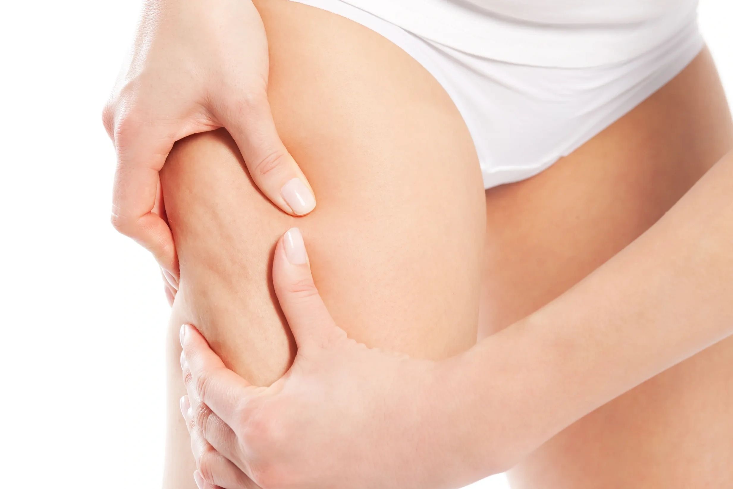 Femme touchant sa cuisse avec cellulite.