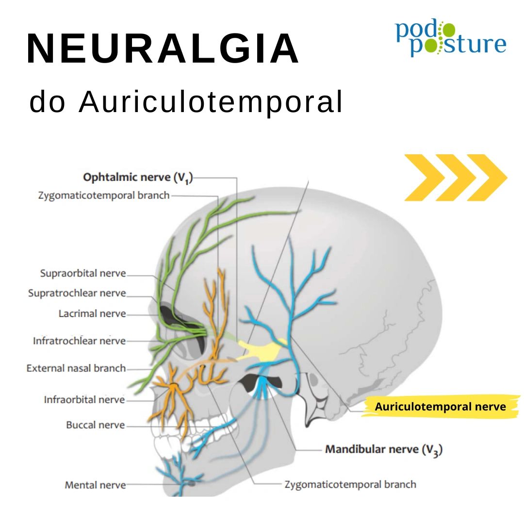 Neuralgia do Auriculotemporal