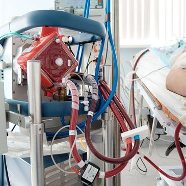 ECMO machine providing critical respiratory support for severe lung failure