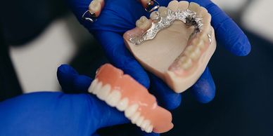Dental technician holding two types of dentures.