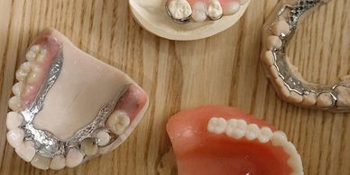 Various dental prosthetics and dentures on a wooden table.