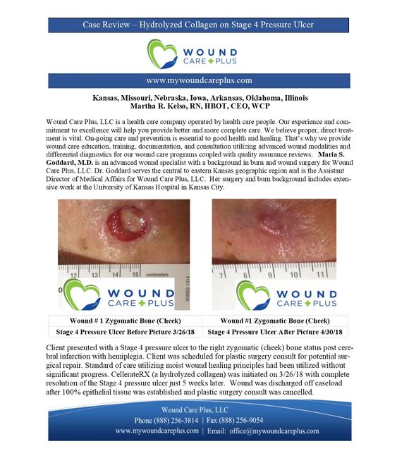 Case Studies Wound Care Plus, LLC