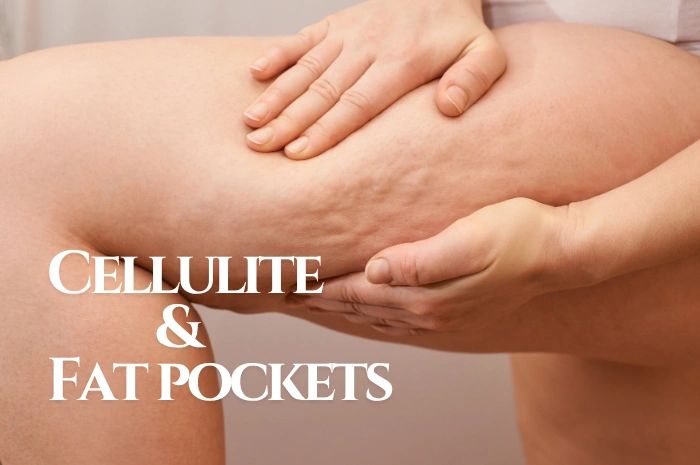 Close-up of thigh with cellulite and fat pockets.