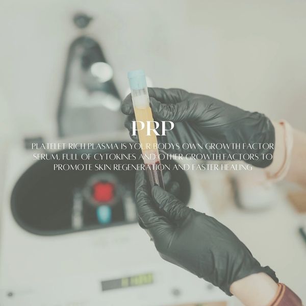 The Vampire facial or PRP Microneedling add-on. 