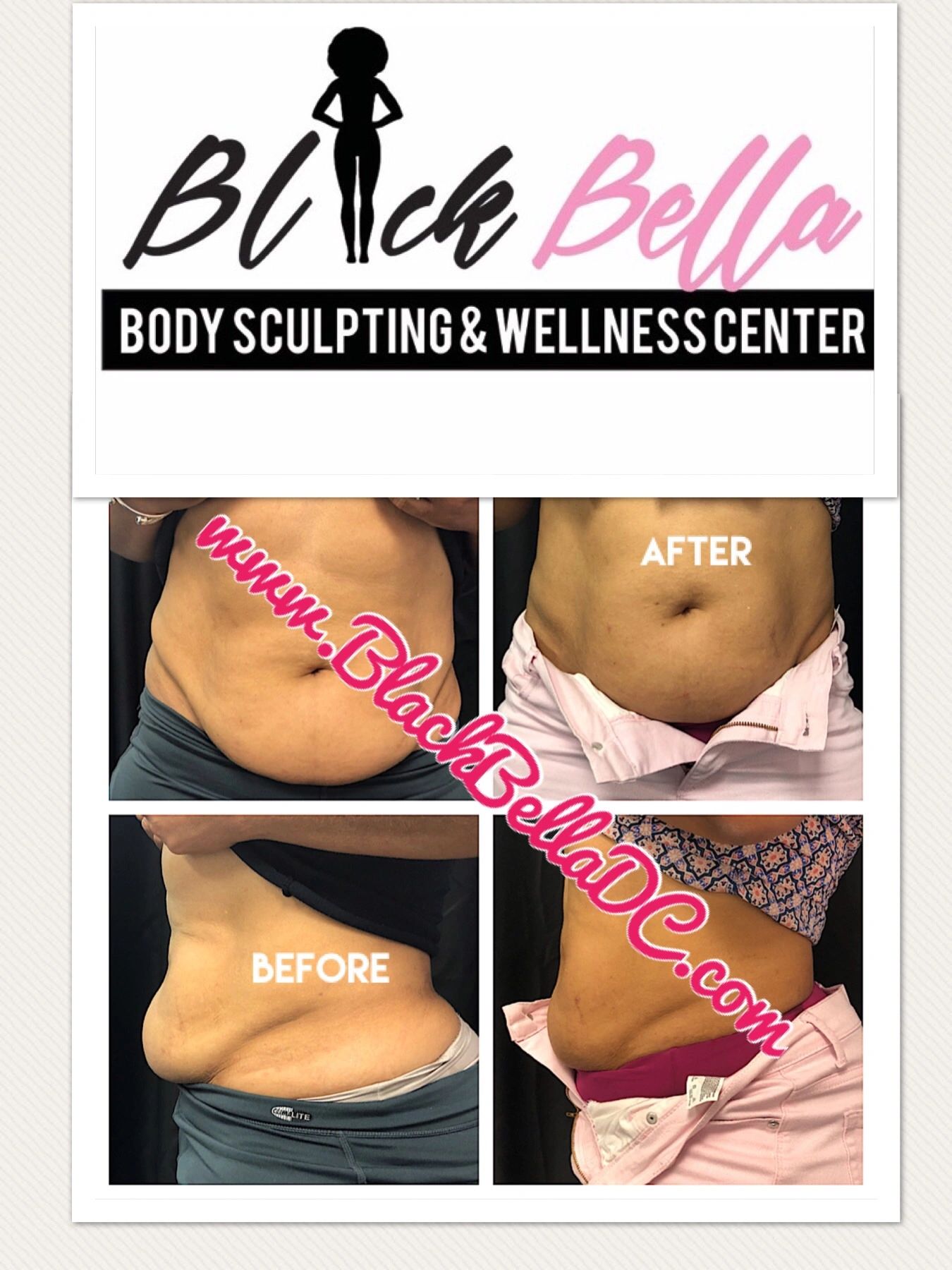 A Bella Bodies before and after! How cool it that? The most divine