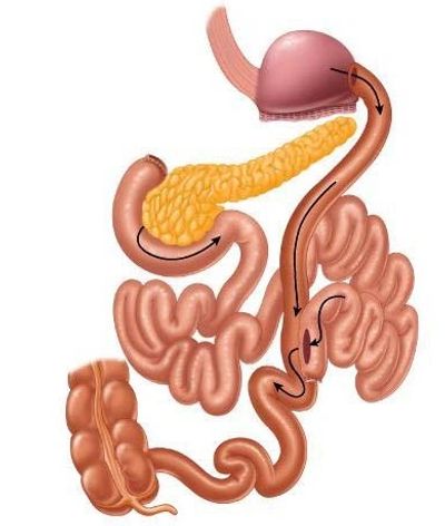 Obezite, Obezite Cerrahisi, Metabolik Cerrahi, Şeker Hastalığı, Tüp Mide,Mide Botoksu