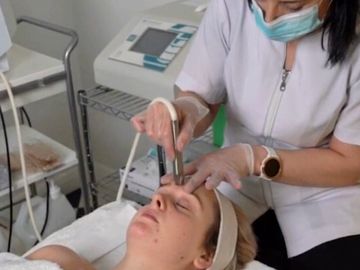 Microdermabrasion  facial treatment #ladysbeautycare