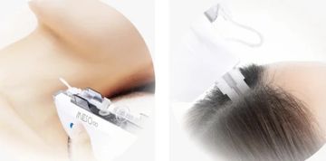 Mesotherapy Treatment for Face or Scalp