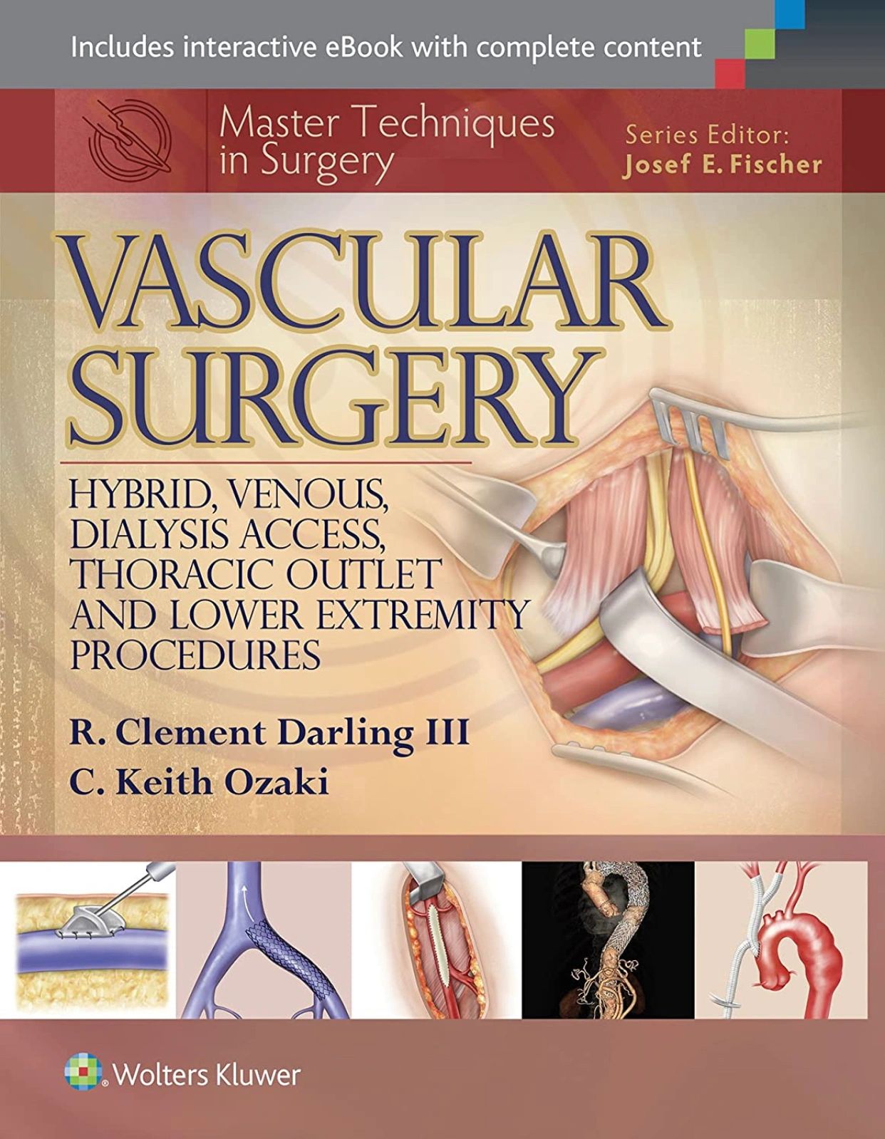 Anatomic Exposures in Vascular Surgery: 9780781741019