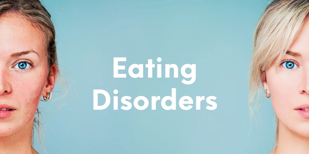 Eating Disorders Mind Mode Psychological Services 