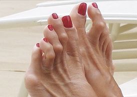 Toe Joint Repair, Hammertoes, Toe Cramps, High Heels, Stiff Toes, Sore Feet, Toe Pain, Bunions