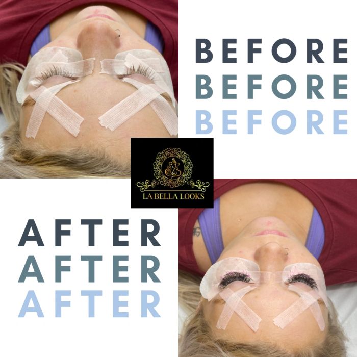 Skincare: facials and peels