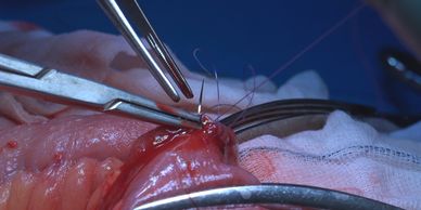 Close-up of a surgical procedure involving delicate stitching.