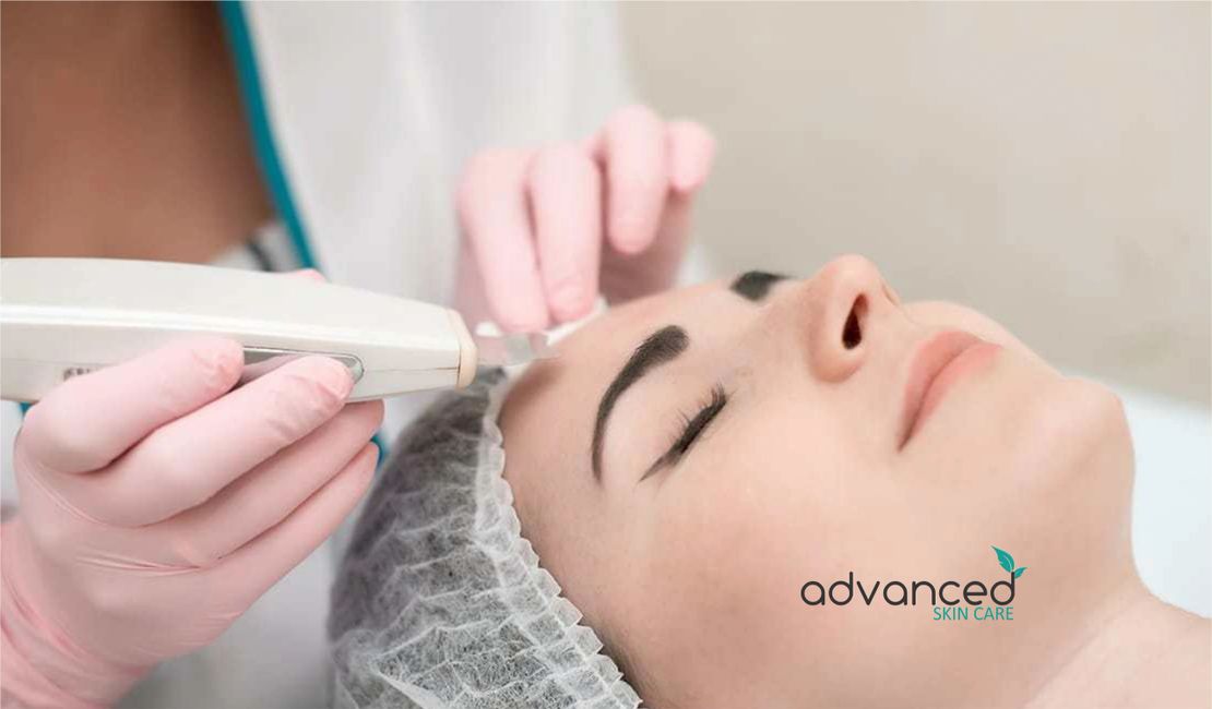 Microneedling - Advanced Skin Care